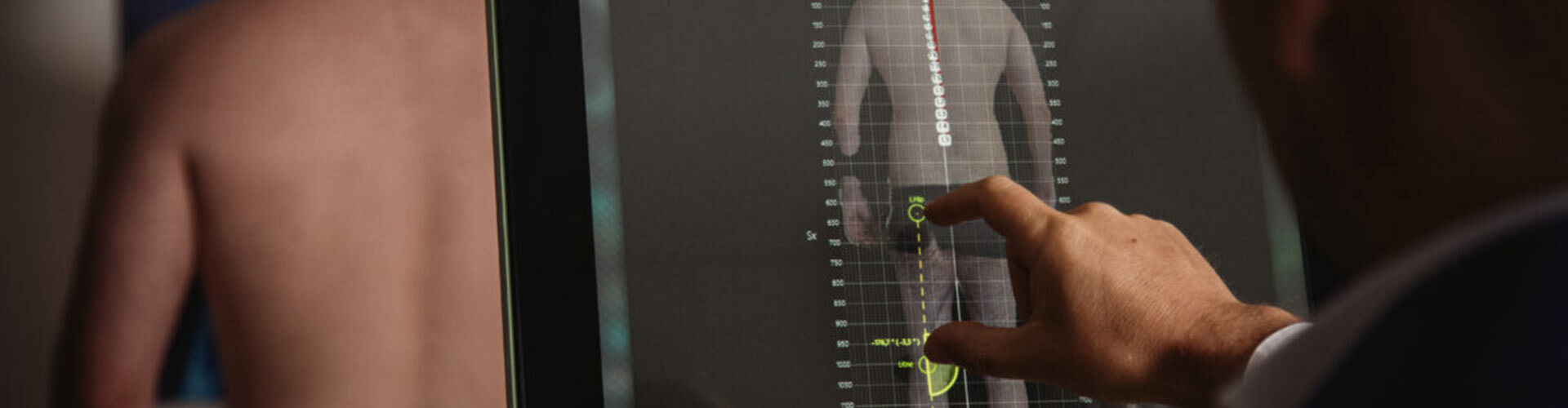 Spine 3D – urządzenie do analizy postawy ciała